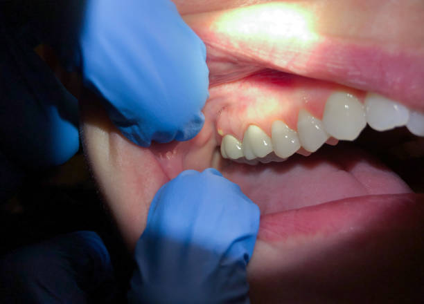 Best Urgent Care for Lost Fillings or Crowns in Tracy, CA