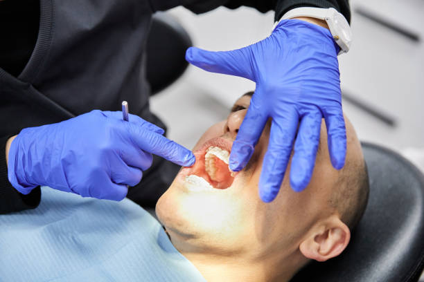 Best Emergency Gum Treatment in Tracy, CA